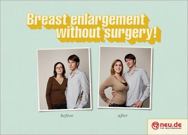 Breast Enlargement