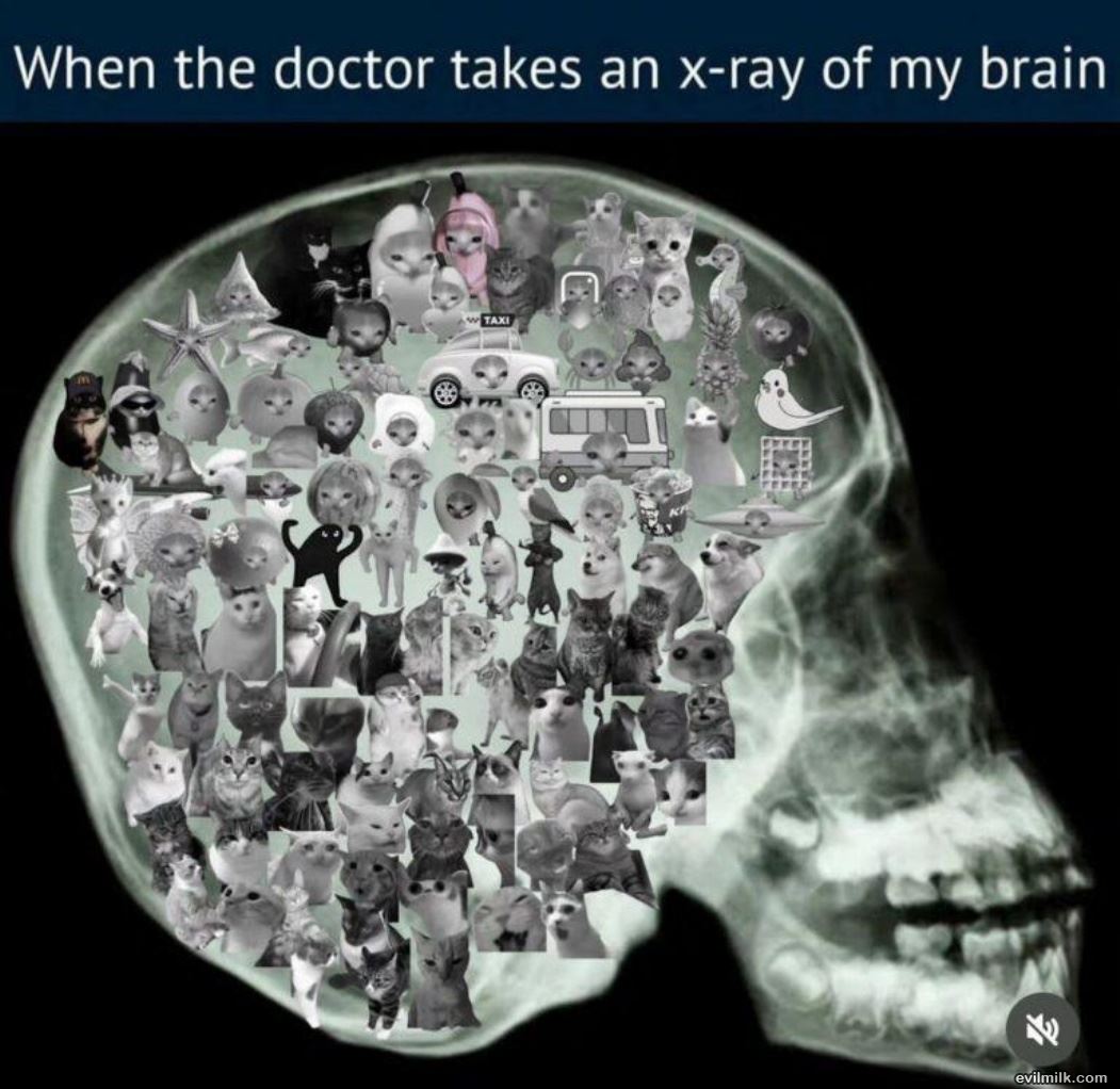 My Brain