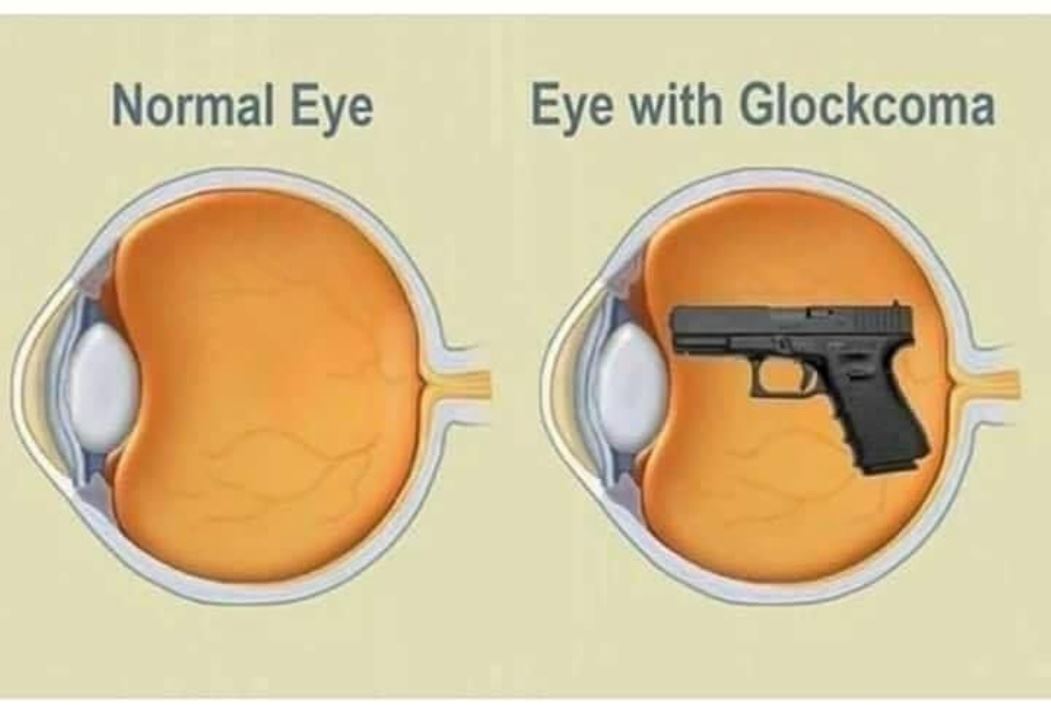 Normal Eye