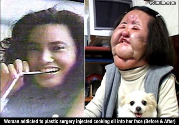 Plastic Surgery Addict