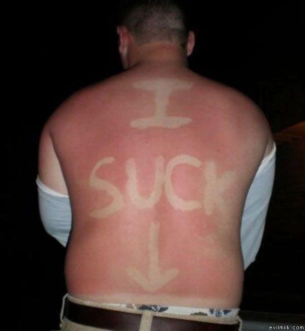 Sucky Sunburn