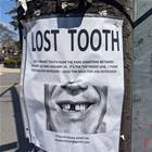 Lost Tooth